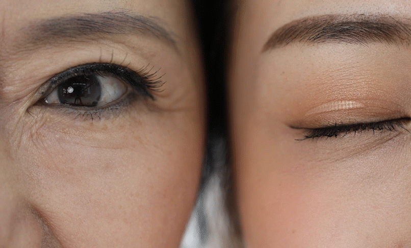 白內(nèi)障癥狀