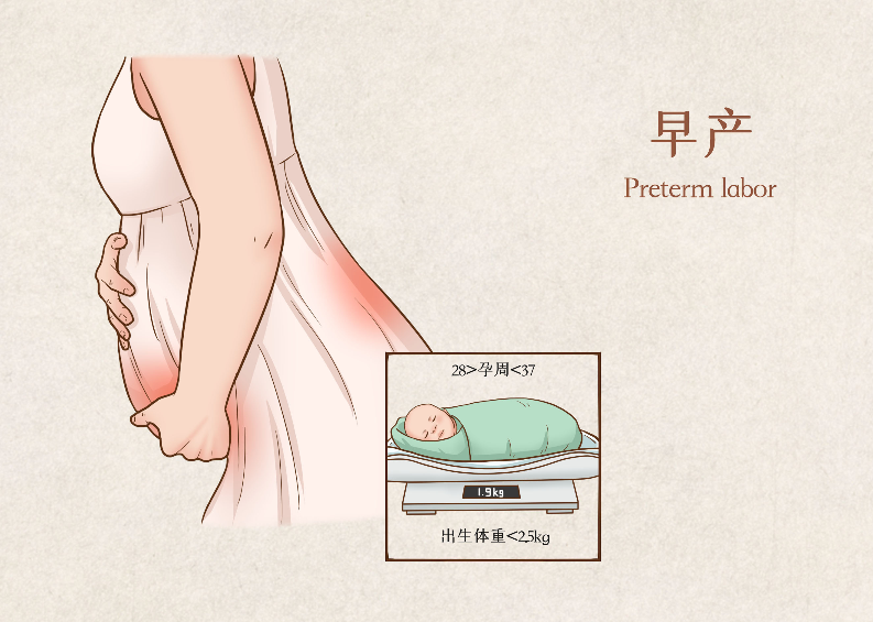 早產(chǎn)兒視網(wǎng)膜病變