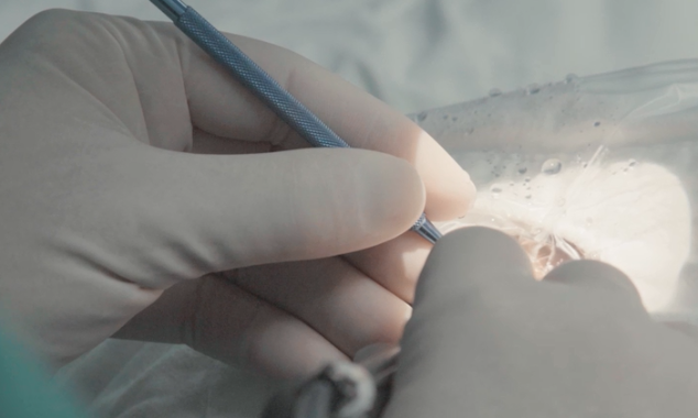 白內(nèi)障手術(shù)